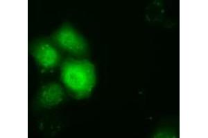 Anti-TTC32 mouse monoclonal antibody (ABIN2453737) immunofluorescent staining of COS7 cells transiently transfected by pCMV6-ENTRY TTC32 (RC209334). (TTC32 antibody)