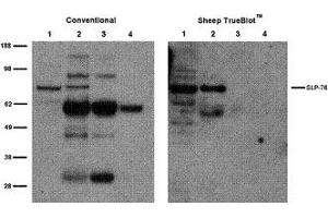 Sheep TrueBlot® IP / Western Blot: Jurkat cell lysate (500 µg) was incubated with 2 µg of sheep anti-SLP76 and immunoprecipitated using Protein G. (Sheep TrueBlot® Anti-Sheep IgG HRP)