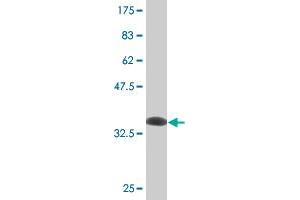 Western Blot detection against Immunogen (35. (RING1 antibody  (AA 81-170))