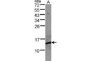WB Image Sample(30 μg of whole cell lysate) A:Raji , 15% SDS PAGE antibody diluted at 1:500 (beta-2 Microglobulin antibody)