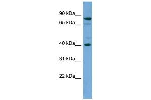 WB Suggested Anti-PNMA2 Antibody Titration: 0. (PNMA2 antibody  (Middle Region))