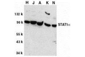 Western blot analysis of STAT1 alpha in whole cell lysates from HeLa (H), Jurkat (J), A431 (A), K562 (K), and NIH3T3 (N) cells, with this product at 1 μg/ml. (STAT1 antibody  (C-Term))