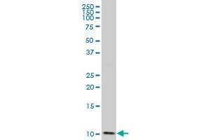 DYNLL2 polyclonal antibody (A01), Lot # 060516JCS1 Western Blot analysis of DYNLL2 expression in SJCRH30 . (DYNLL2 antibody  (AA 1-72))