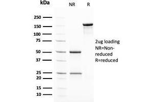 SDS-PAGE Analysis Purified Insulin Mouse Monoclonal Antibody (2D11-H5). (Insulin antibody)