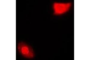 Immunofluorescent analysis of SGTA staining in MCF7 cells. (SGTA antibody)