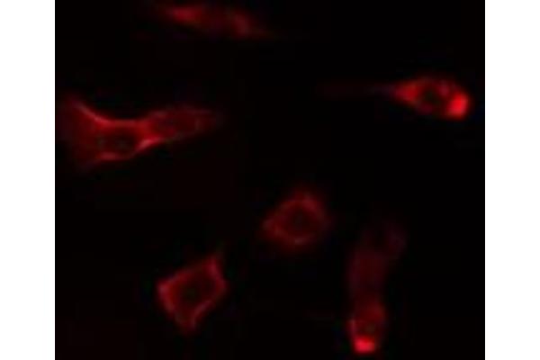 NT5C1A antibody  (Internal Region)