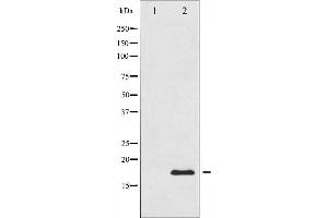 Western blot analysis of Acetyl-Histone H3 phosphorylation expression in TSA treated RAW264. (Histone 3 antibody  (H3K9ac))