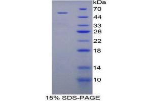 SDS-PAGE (SDS) image for Angiopoietin-Like 3 (ANGPTL3) (AA 237-455) protein (His tag,GST tag) (ABIN2122403)