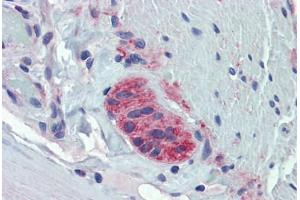 Human Small Intestine, Myenteric Plexus: Formalin-Fixed, Paraffin-Embedded (FFPE) (TUBB2A antibody  (AA 254-303))