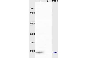Lane 1: human colon carcinoma lysates Lane 2: mouse intestine lysates probed with Anti IQCJ Polyclonal Antibody, Unconjugated (ABIN1387803) at 1:200 in 4 °C. (IQCJ antibody  (AA 47-67))