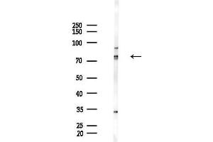 anti-Ecdysoneless Homolog (ECD) (Internal Region) antibody