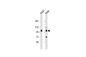 All lanes : Anti-IGF1 Receptor (IGF1R) Antibody (C-term) at 1:2000 dilution Lane 1: A431 whole cell lysate Lane 2: Hela whole cell lysate Lysates/proteins at 20 μg per lane. (IGF1R antibody  (C-Term))