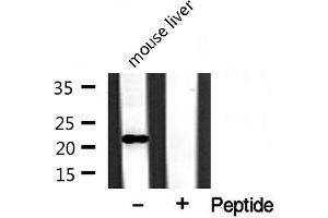 Western blot analysis of extracts from mouse liver, using BST2 antibody. (BST2 antibody  (Internal Region))