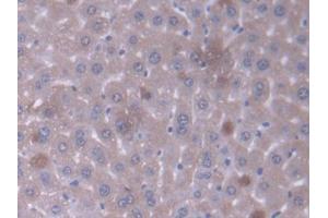 DAB staining on IHC-P; Samples: Mouse Liver Tissue (GCDH antibody  (AA 270-438))