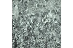 IHC on mouse brain (cryo section) using Rabbit antibody to Synaptotagmin 17  at a concentration of 50 µg/ml incubated overnight at 4C. (SYT17 antibody  (Internal Region))