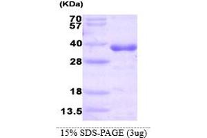 SDS-PAGE (SDS) image for Histamine N-Methyltransferase (HNMT) (AA 1-292) protein (His tag) (ABIN667093)