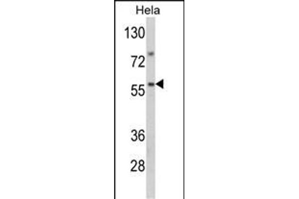 SARS2 antibody  (AA 315-344)