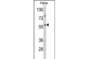 Western blot analysis of SARS2 Antibody (Center) (ABIN392301 and ABIN2841955) in Hela cell line lysates (35 μg/lane). (SARS2 antibody  (AA 315-344))
