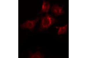 ABIN6268794 staining Hela by IF/ICC. (EPH Receptor B2 antibody  (C-Term))