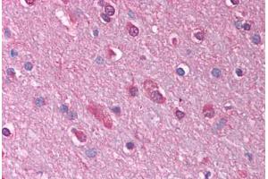 Human Brain, Cortex (formalin-fixed, paraffin-embedded) stained with GABRQ antibody ABIN214762 at 2. (GABRQ antibody  (AA 31-80))