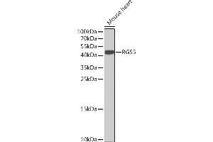 Western blot analysis of extracts of Mouse heart, using RGS5 Rabbit pAb (ABIN6130676, ABIN6146924, ABIN6146925 and ABIN6222790) at 1:1000 dilution. (RGS5 antibody  (AA 1-181))