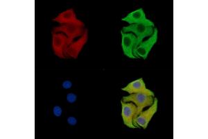 ABIN7096999 and ABIN7101066 staining Hela cells by IF/ICC.