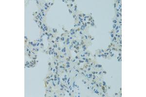 Immunohistochemistry of paraffin-embedded rat lung using MBD2 antibody (ABIN5971247) at dilution of 1/100 (40x lens). (MBD2 antibody)