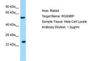 Host: RabbitTarget Name: RGS9BPAntibody Dilution: 1. (Regulator of G Protein Signaling 9 Binding Protein (RGS9BP) (N-Term) antibody)