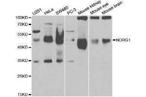 Western blot analysis of extracts of various cell lines, using NDRG1 antibody. (NDRG1 antibody  (AA 175-394))