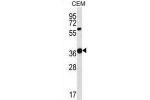 Western Blotting (WB) image for anti-Wingless-Type MMTV Integration Site Family, Member 16 (WNT16) antibody (ABIN2997219) (WNT16 antibody)