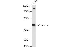 Western blot analysis of extracts of HeLa cells, using Caldesmon antibody (ABIN7266024) at 1:1000 dilution. (Caldesmon antibody)