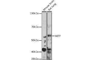 Western blot analysis of extracts of various cell lines, using MITF Rabbit mAb (ABIN7268511) at 1:1000 dilution. (MITF antibody)