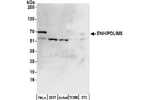 Western Blotting (WB) image for anti-PDZ and LIM Domain 5 (PDLIM5) (AA 546-596) antibody (ABIN7449679)