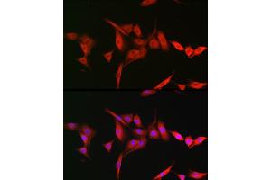 Immunofluorescence analysis of NIH-3T3 cells using TRIM31 Rabbit pAb (ABIN7270987) at dilution of 1:200 (40x lens). (TRIM31 antibody  (AA 186-425))