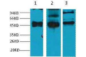 Western Blotting (WB) image for anti-Keratin 17 (KRT17) antibody (ABIN3178634) (KRT17 antibody)