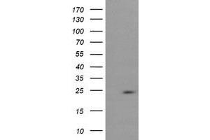 Image no. 2 for anti-RAB37, Member RAS Oncogene Family (RAB37) antibody (ABIN1500565) (RAB37 antibody)