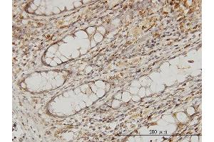 Immunoperoxidase of monoclonal antibody to MAPRE2 on formalin-fixed paraffin-embedded human colon. (MAPRE2 antibody  (AA 1-62))