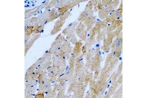 Immunohistochemical analysis of TTLL12 staining in rat heart formalin fixed paraffin embedded tissue section. (TTLL12 antibody)