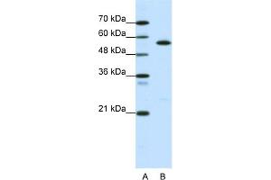 WB Suggested Anti-CORO1A Antibody Titration:  0. (Coronin 1a antibody  (Middle Region))