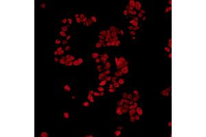Immunofluorescence (IF) image for anti-Fused in Sarcoma (FUS) (AA 1-50) antibody (ABIN7454040) (Recombinant FUS antibody  (AA 1-50))