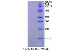 SDS-PAGE (SDS) image for Parathyroid Hormone (PTH) (AA 32-119) protein (His tag) (ABIN1080451)
