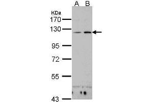 WB Image Sample(30 ug whole cell lysate) A:H1299 B:Hep G2 , 7. (CD11c antibody  (N-Term))
