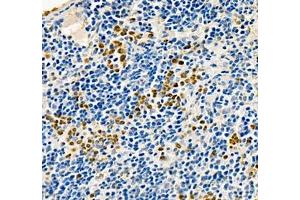 Immunohistochemistry of paraffin embedded mouse spleen using ANXA3 (ABIN7073065) at dilution of 1: 200 (400x lens) (Annexin A3 antibody)