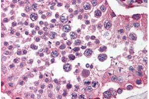Human Testis (formalin-fixed, paraffin-embedded) stained with SIRPA antibody ABIN214476 at 2. (SIRPA antibody  (C-Term))