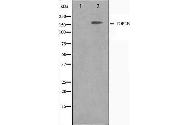 TOP2B antibody  (N-Term)