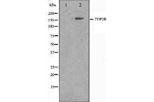 Western blot analysis on Jurkat cell lysate using TOP2B Antibody. (TOP2B antibody  (N-Term))