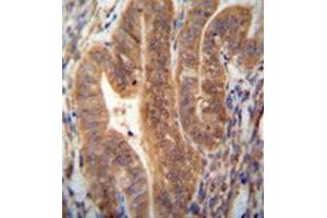 Immunohistochemistry analysis in formalin fixed and paraffin embedded human uterus tissue reacted with KIAA1644 antibody (N-term) followed which was peroxidase conjugated to the secondary antibody and followed by DAB staining. (SHISAL1/KIAA1644 antibody  (N-Term))