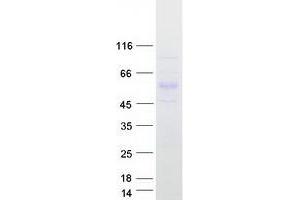 Validation with Western Blot (PPARD Protein (Transcript Variant 1) (Myc-DYKDDDDK Tag))