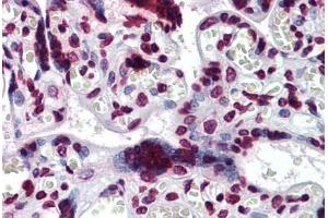 Human Placenta: Formalin-Fixed, Paraffin-Embedded (FFPE) (BAZ1B antibody  (AA 1384-1484))