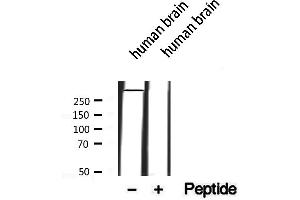 Western blot analysis of extracts from Human brain, using MAP1B antibody. (MAP1B antibody  (Internal Region))